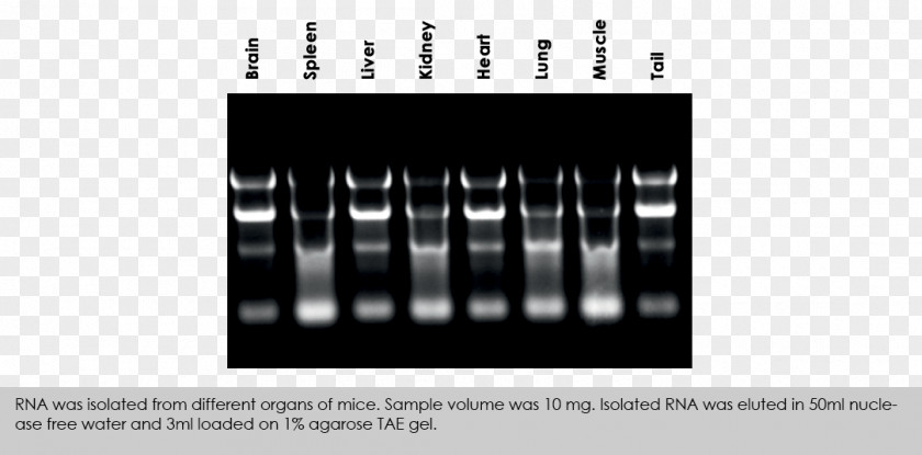 Disinfection And Purification Of Blood Mycoplasma RNA Extraction Gel Electrophoresis Buffer Solution PNG