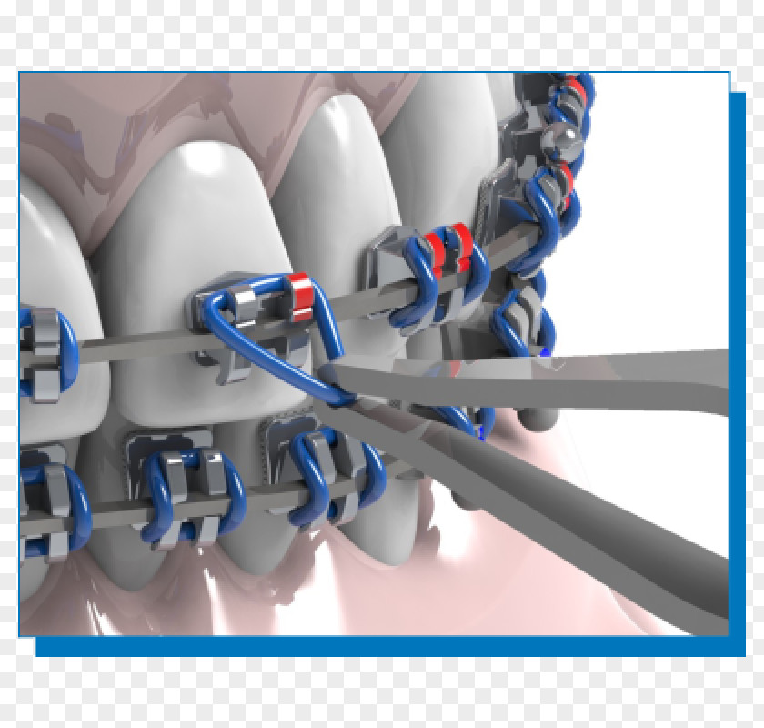 Ortodoncia Clínica União Passos Orthodontics Dentistry Dental Braces PNG