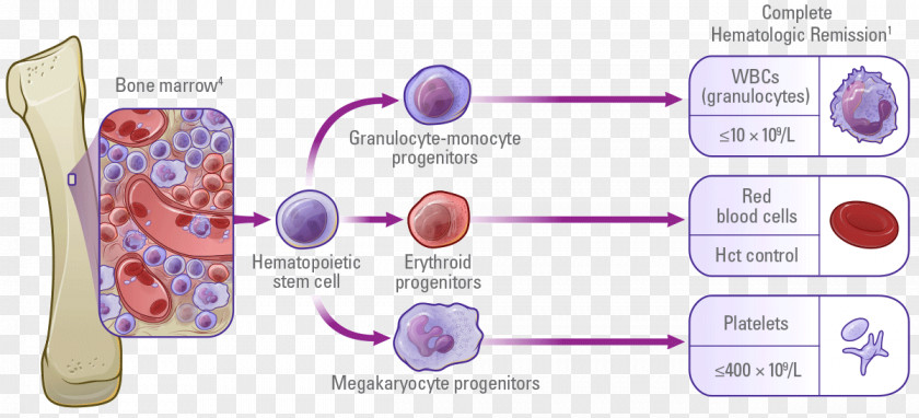 Myelofibrosis Polycythemia Vera Ruxolitinib Multiple Myeloma Hydroxycarbamide PNG