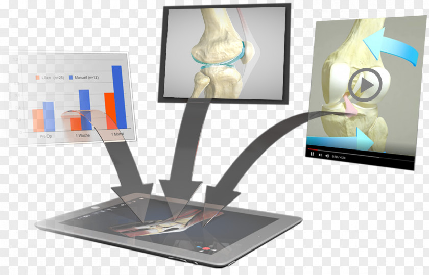 Patella Knee Homo Sapiens Anatomy Effigos AG PNG