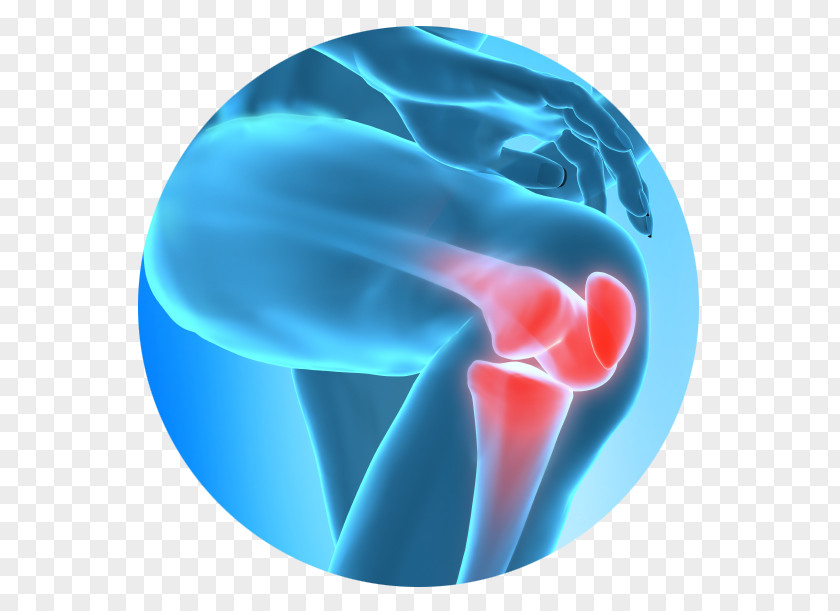 Knee Pain Injury Therapy Management PNG