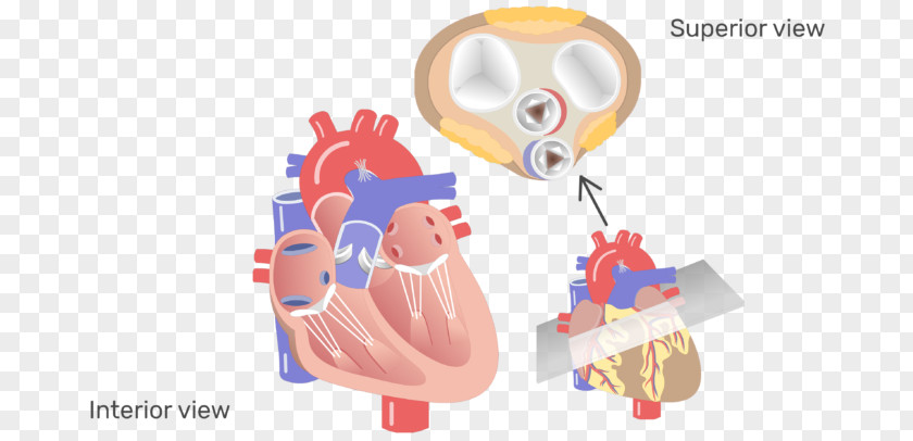 Heart Valve Aortic Disease Aorta PNG