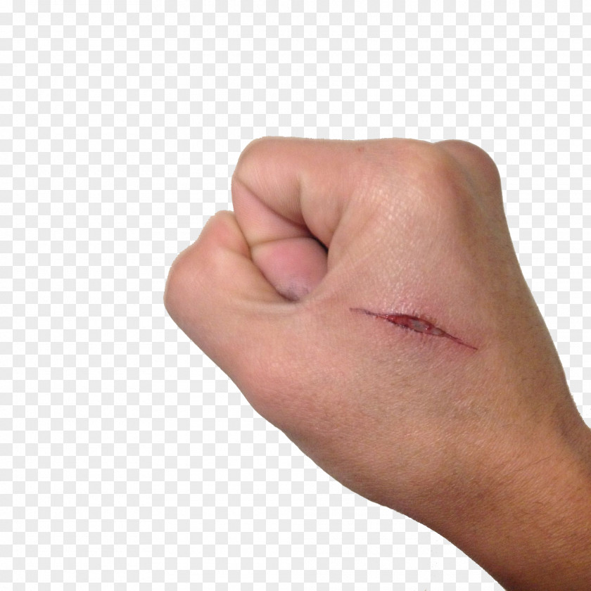 The Hands Of Knife Marks Hand Thumb Scar PNG
