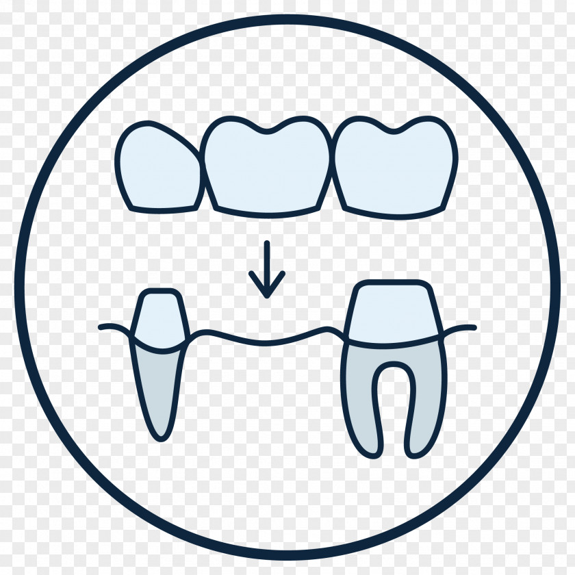 Dental Tooth Dentist Crown Dentures Streeter PNG
