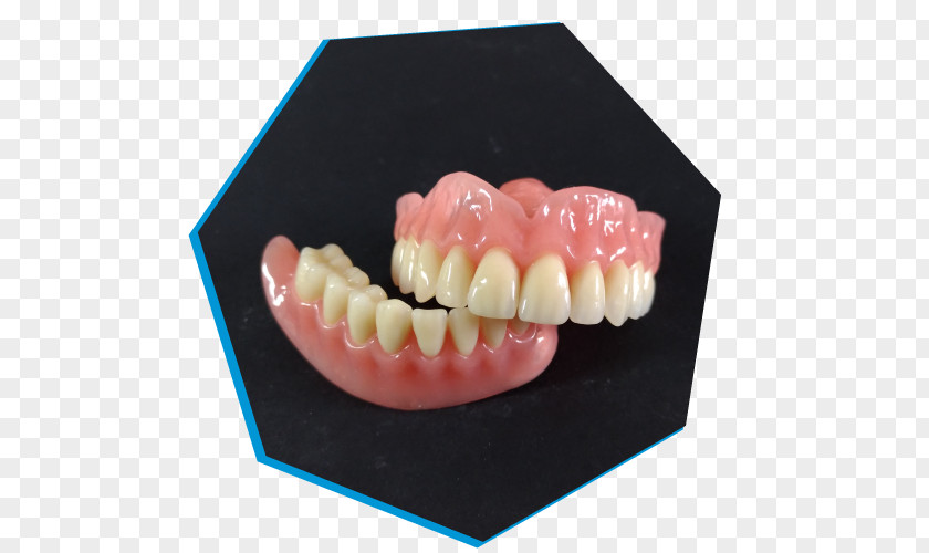Dental Technology Brembio Laboratory Dentures Tooth Sant'Angelo Lodigiano PNG
