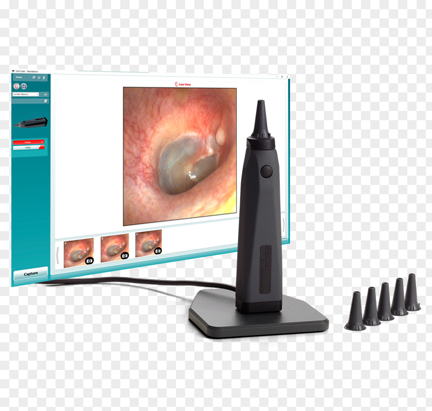 Ahsaudiology Hearing Solutions Otoscope Audiometry Computer Monitors Otoscopia Otoskopie PNG