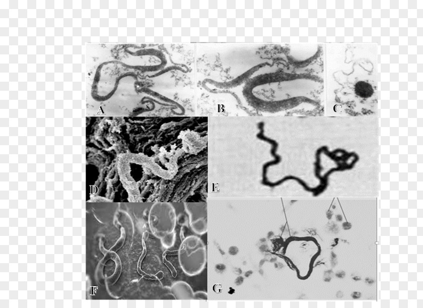 Microscope L-form Bacteria Virus Tuberculosis PNG