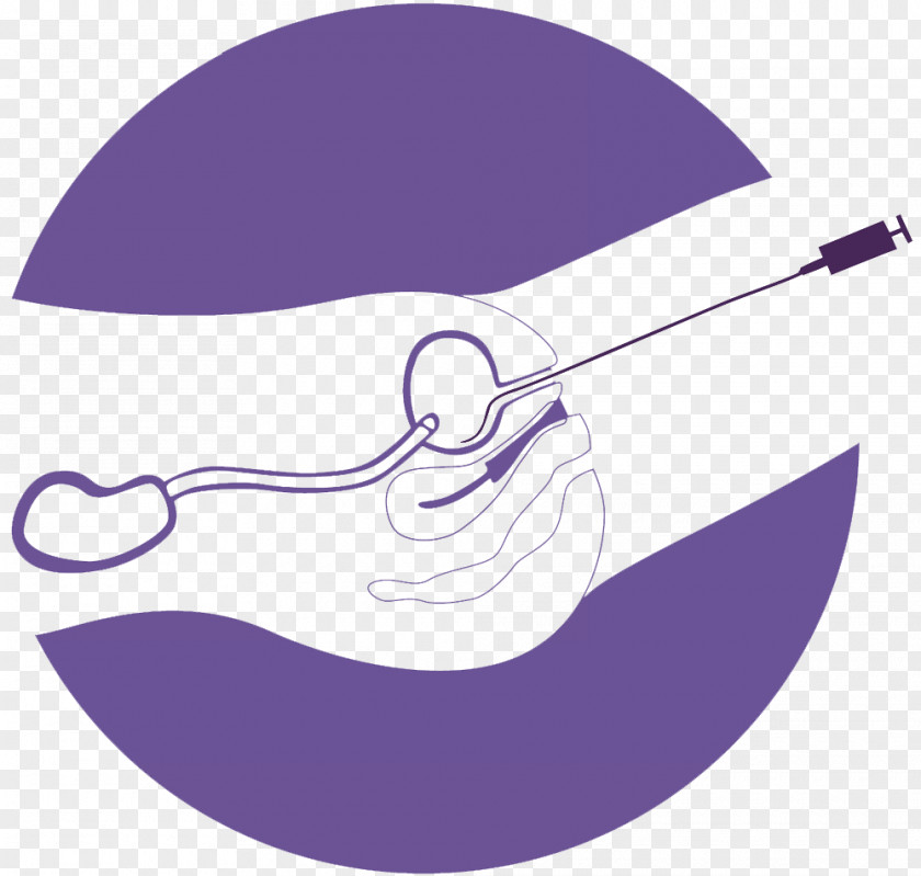 Cystoscopy Hexvix Cysview Bladder Cancer Urinary PNG