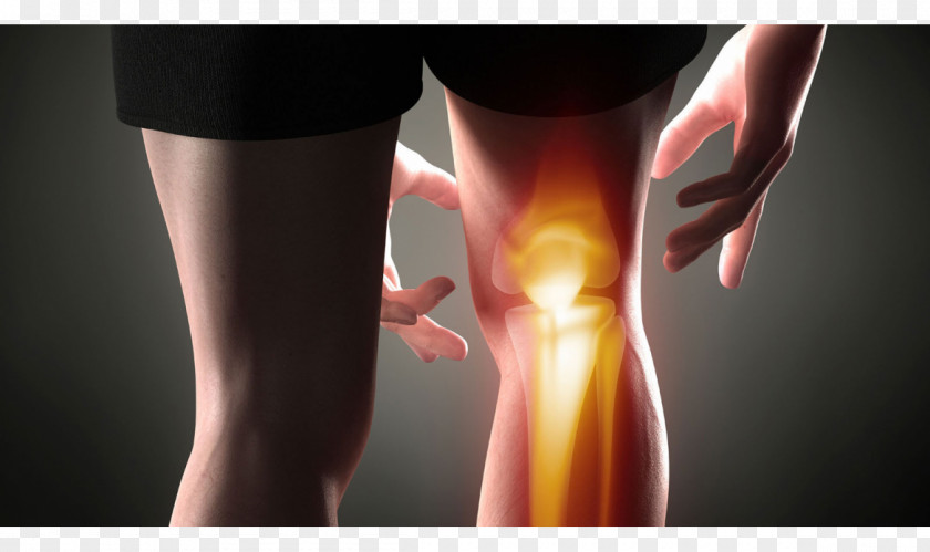 Joint Pain Knee Arthritis Management Osteoarthritis PNG