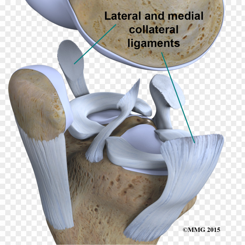 Knee Joint Anterior Cruciate Ligament Sprains And Strains PNG