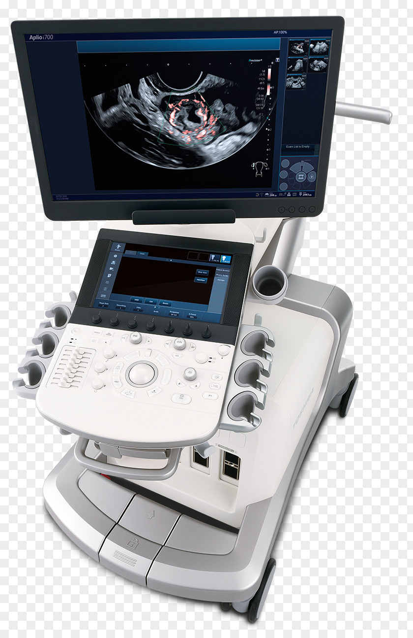 Ultrasound Ultrasonography Canon Medical Systems Corporation Medicine Imaging PNG