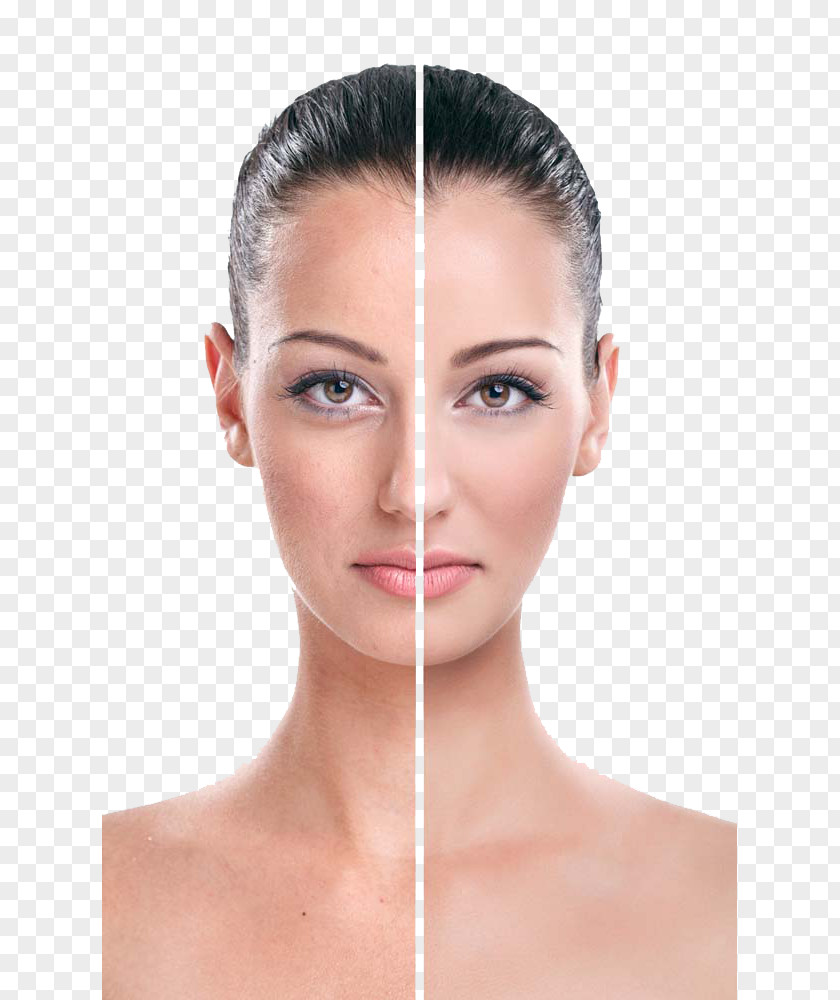 White Contrast Beautiful Models Rhytidectomy Eye Face Wrinkle Cream PNG