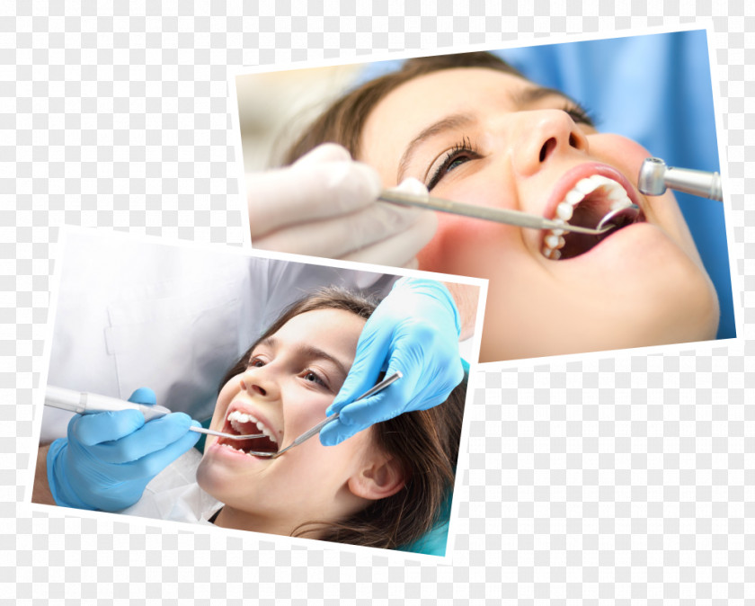 Health Dentistry Care Dental Implant PNG