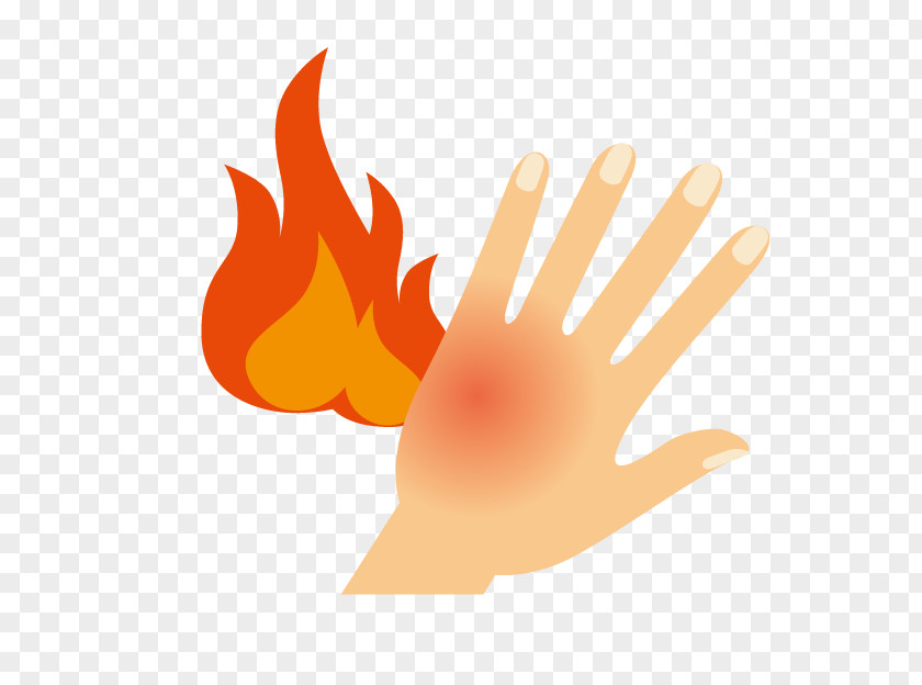 Cartoon Hand Burns Burn Gout Skin PNG