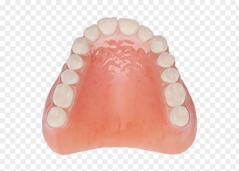 Aspen Dental Tooth Dentures Dentistry Removable Partial Denture PNG