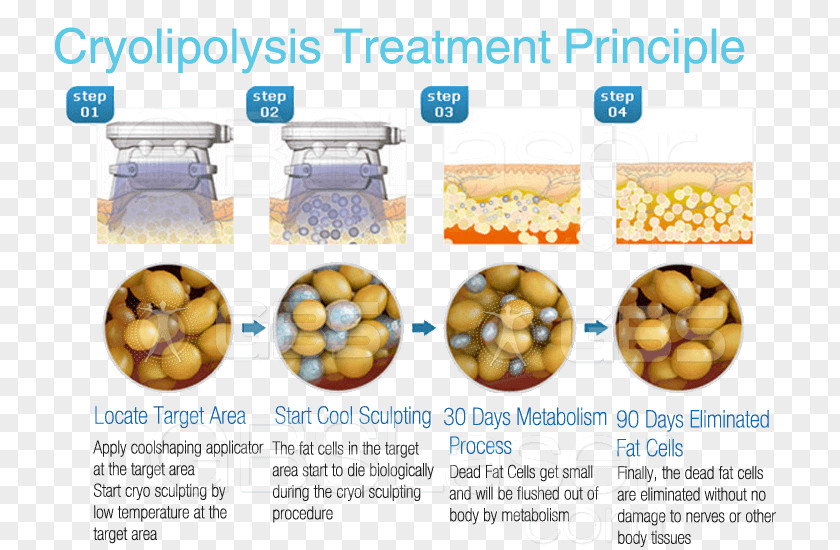 Weighing-machine Cryolipolysis Adipose Tissue Adipocyte Fat Apoptosis PNG