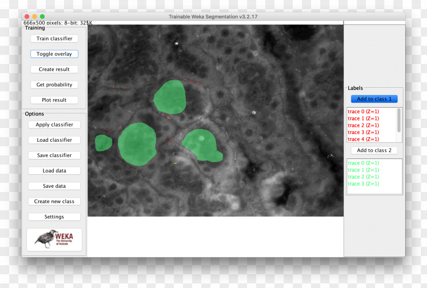 Four Year Strong ImageJ Information National Institutes Of Health PNG