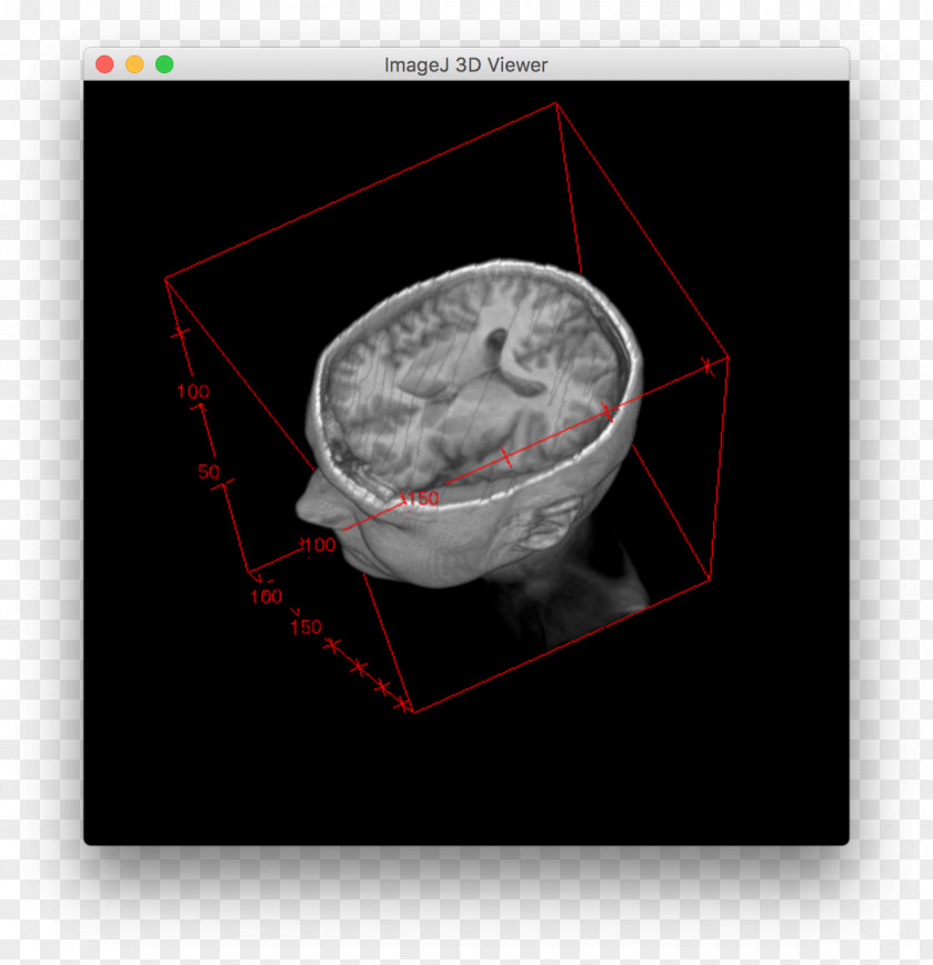 Segmentation Line ImageJ Macro Fiji GitHub Computer Programming PNG