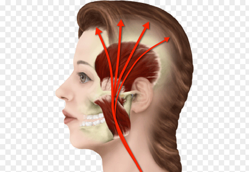 Neck Pain Myofascial Syndrome Orofacial Headache Face PNG