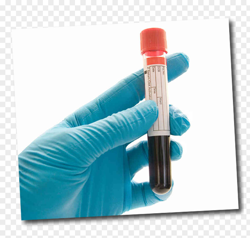 Pathology Lab Blood Test Drug Herpes Simplex Hepatitis B PNG