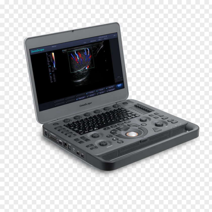 Ultrasound Machine Doppler Ultrasonography SonoScape Medical Corp Color PNG