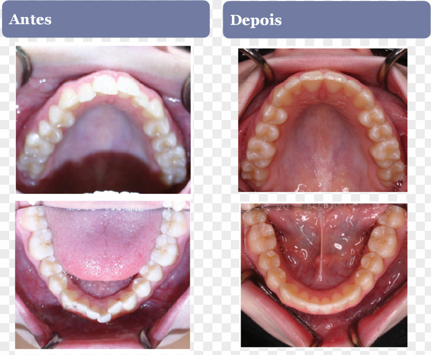 Dentista Close-up Lip PNG