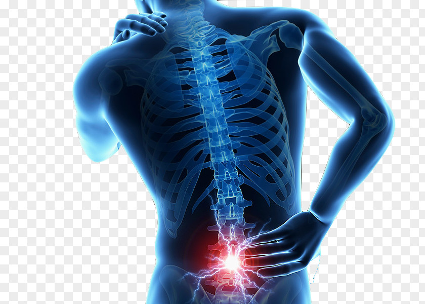 Back Pain Low Human Injury Vertebral Column PNG