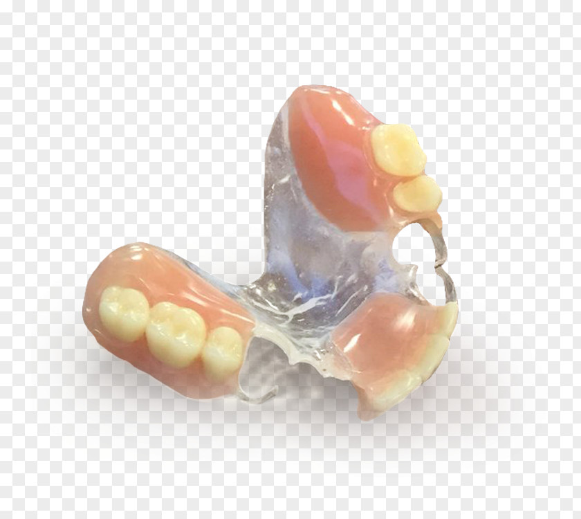 Partial Dentures Tooth Dentistry Manufacturing Dental Impression PNG