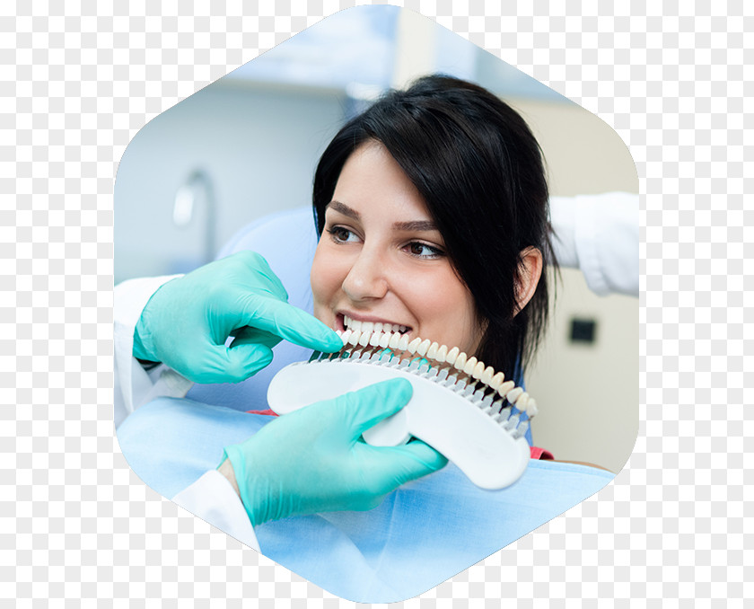 Tooth Whitening Dentist Human Dental Restoration PNG