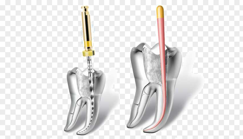 Endodontics Root Canal Dentistry Endodontic Therapy PNG