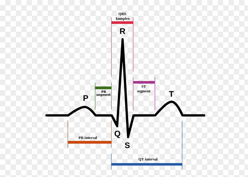 Rhythm Sinus Electrocardiography Heart Tachycardia Atrium PNG