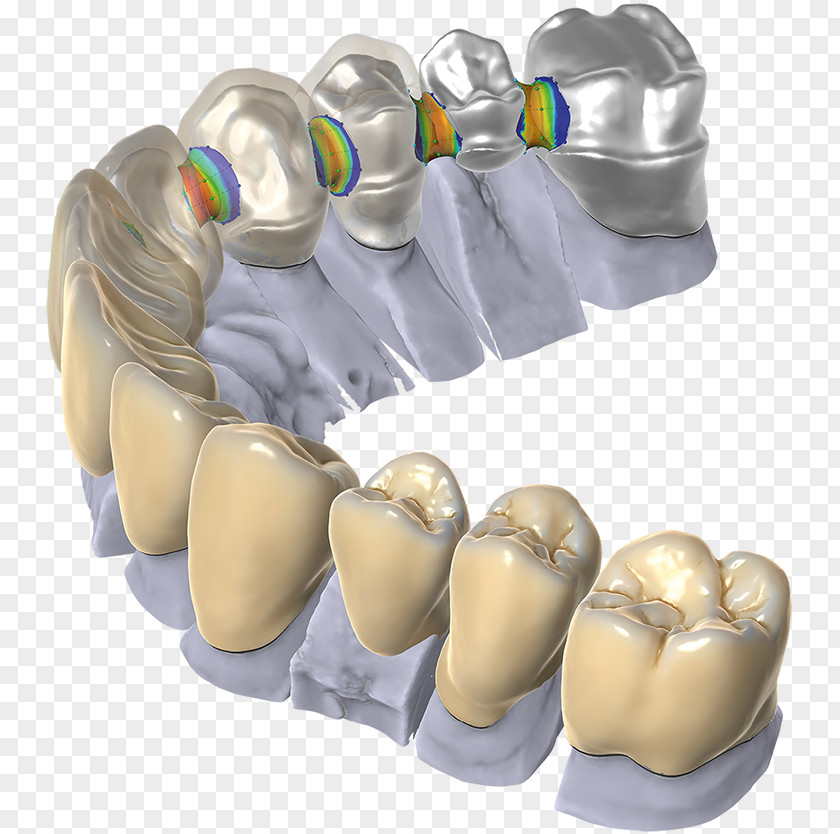 CAD/CAM Dentistry Computer-aided Design Dental Restoration Computer Software PNG