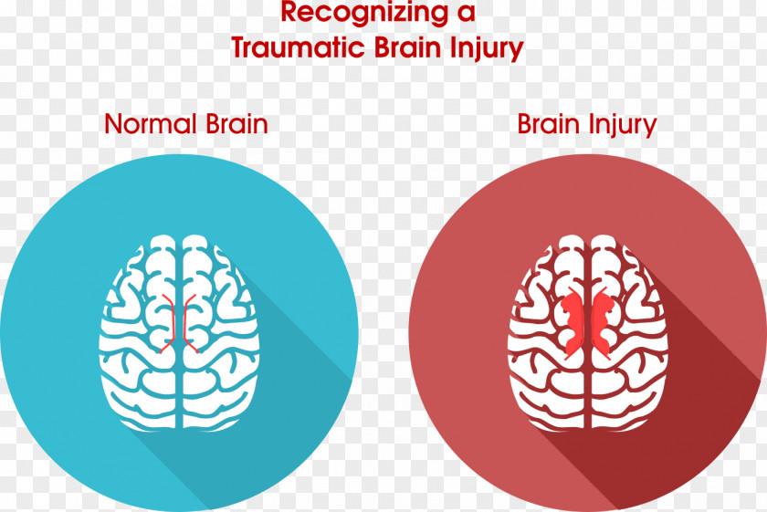 Injury Traumatic Brain Concussion Acquired PNG