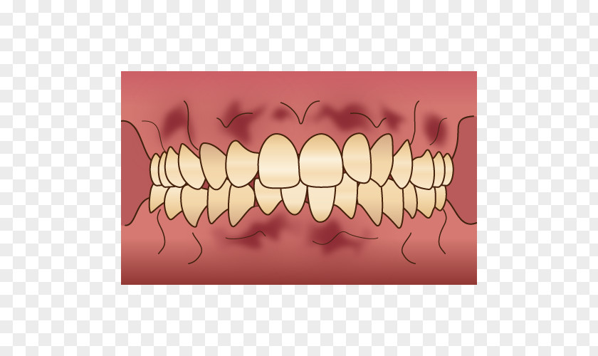 Dental Flyer Tooth 審美歯科 Dentist Gums PNG