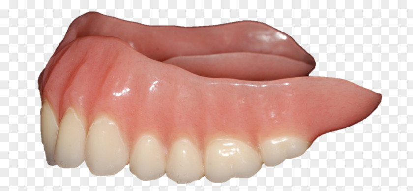Dentures Human Tooth PNG