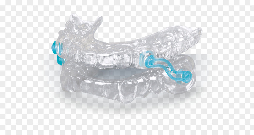 Snoring Mandibular Advancement Splint Sleep Apnea Dentistry PNG