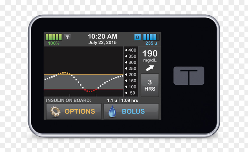 Artificial Pancreas Insulin Pump Tandem Diabetes Care Food And Drug Administration Mellitus PNG