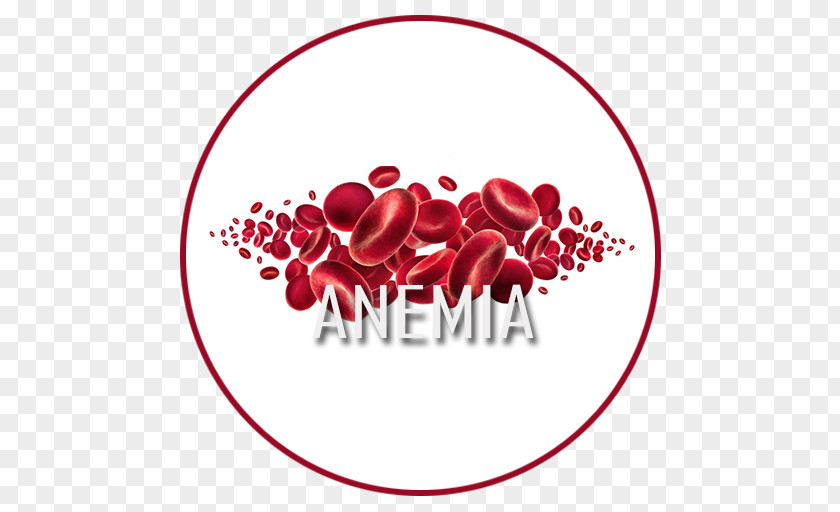 ANEMIA Dietary Supplement Anemia Iron Pain Therapy PNG