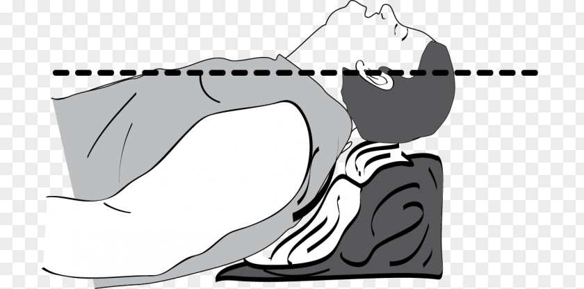 Blood Pressure Machine Tracheal Intubation Airway Management Patient Apnea Anesthesia PNG