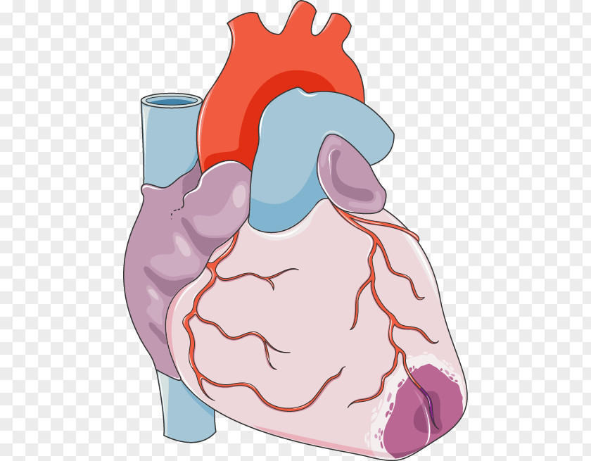 Heart Acute Myocardial Infarction Coronary Artery Bypass Surgery Cardiovascular Disease PNG