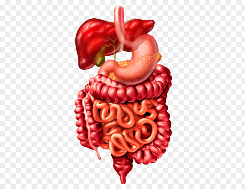 Digestive Tract Crohn's Disease Bowel Obstruction Symptom Inflammatory Large Intestine PNG