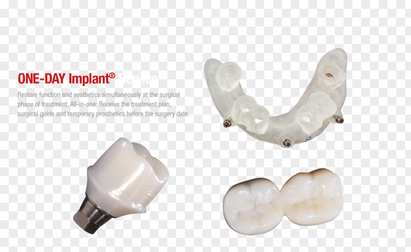 Dental Implants Implant Abutment Temporary Crown CAD/CAM Dentistry PNG