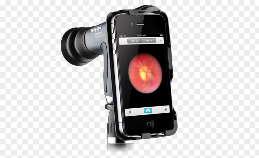 IPhone 4S 6 Welch Allyn Ophthalmoscopy PNG