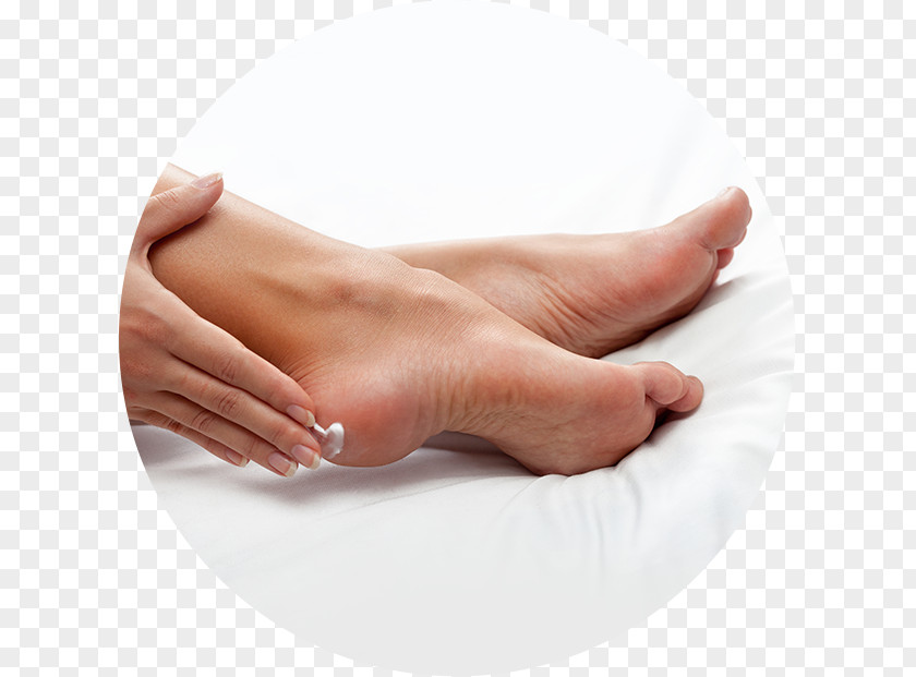 Suffer Damage Lotion Diabetic Foot Heel Skin PNG