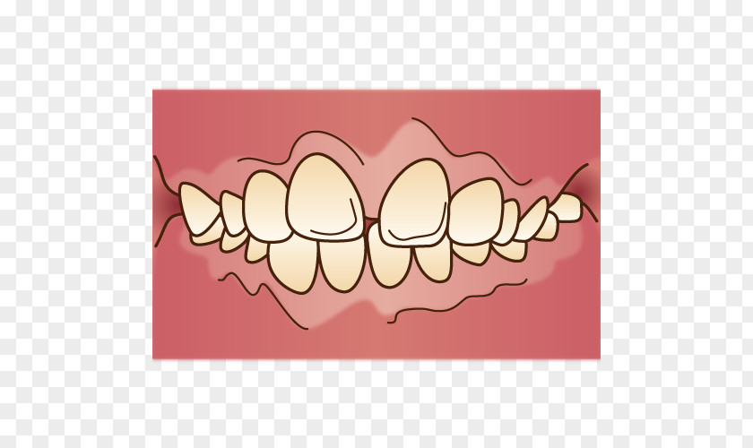 Orthodontics Tooth 矯正歯科 Dentist Dental Braces PNG
