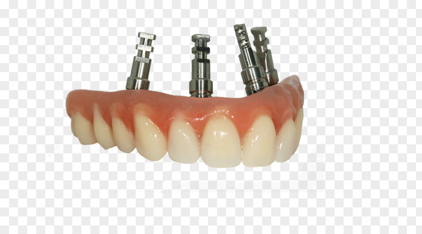 Dental Laboratory Bridge Tooth Dentures Prosthesis Dentistry PNG