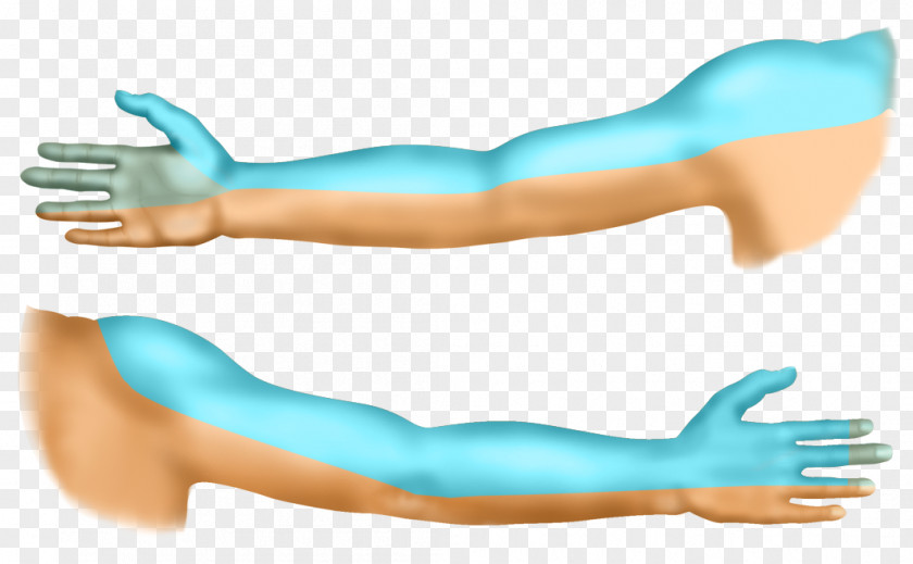 Plexus Living Room Shoulder Supraclavicular Nerves Arm Brachial PNG