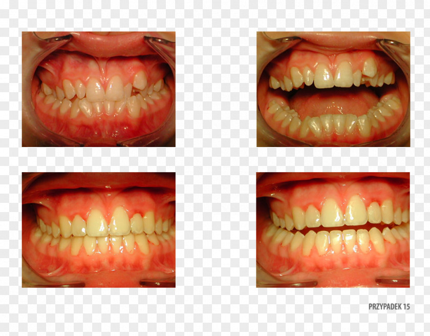 Orange Polska Close-up Therapy Patient PNG