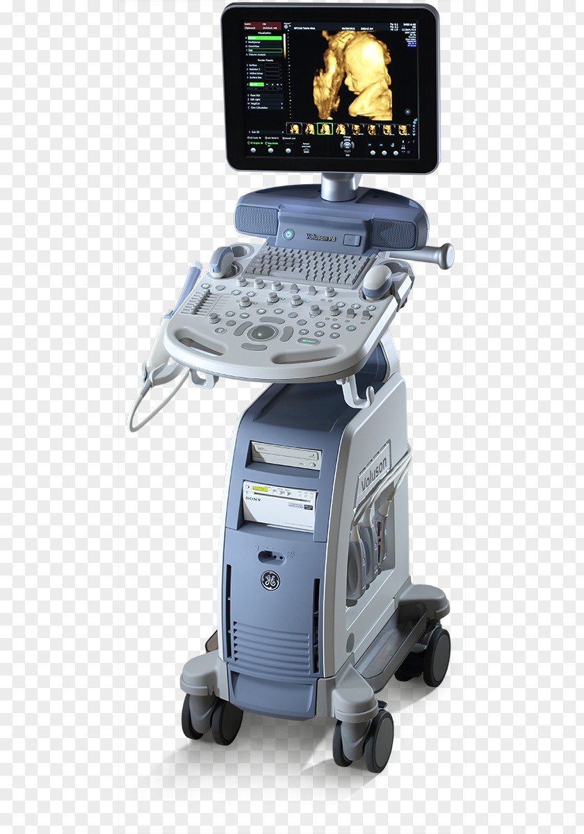 Voluson 730 Ultrasonography Ultrasound GE Healthcare Gynaecology PNG