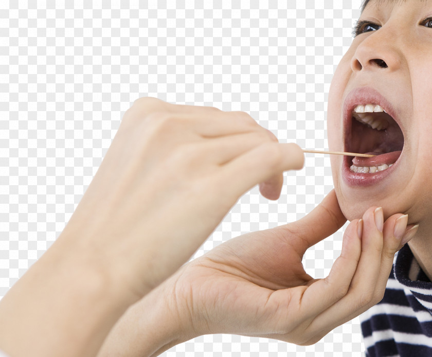 The Child Is Decaying Dentistry Stomatitis Photography PNG